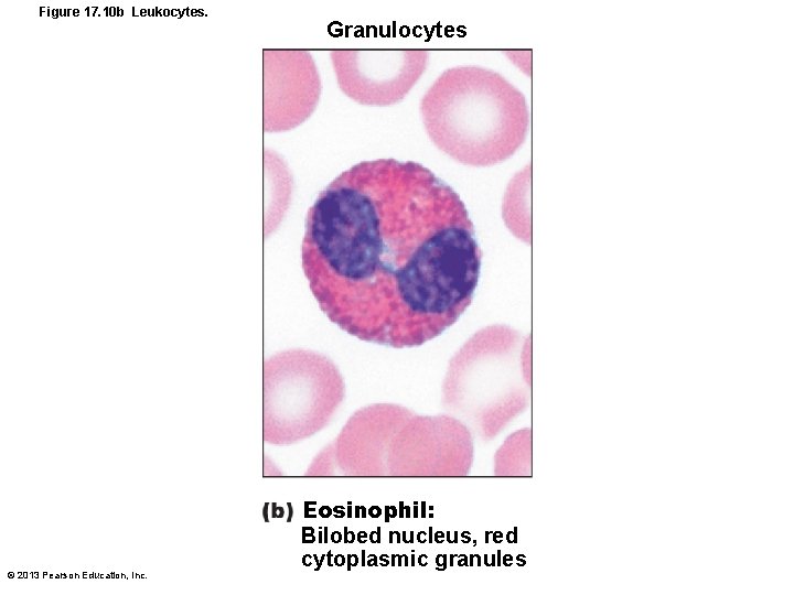 Figure 17. 10 b Leukocytes. © 2013 Pearson Education, Inc. Granulocytes Eosinophil: Bilobed nucleus,