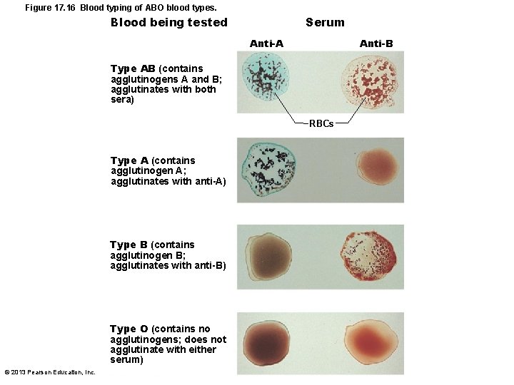 Figure 17. 16 Blood typing of ABO blood types. Serum Blood being tested Anti-B