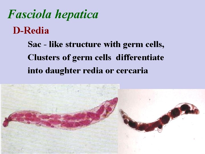 Fasciola hepatica D-Redia Sac - like structure with germ cells, Clusters of germ cells