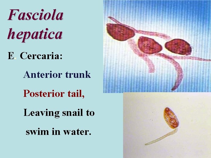 Fasciola hepatica E. Cercaria: Anterior trunk Posterior tail, Leaving snail to swim in water.