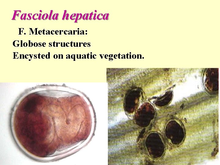  Fasciola hepatica F. Metacercaria: Globose structures Encysted on aquatic vegetation. 