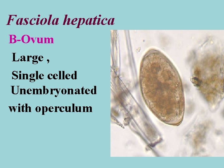 Fasciola hepatica B-Ovum Large , Single celled Unembryonated with operculum 