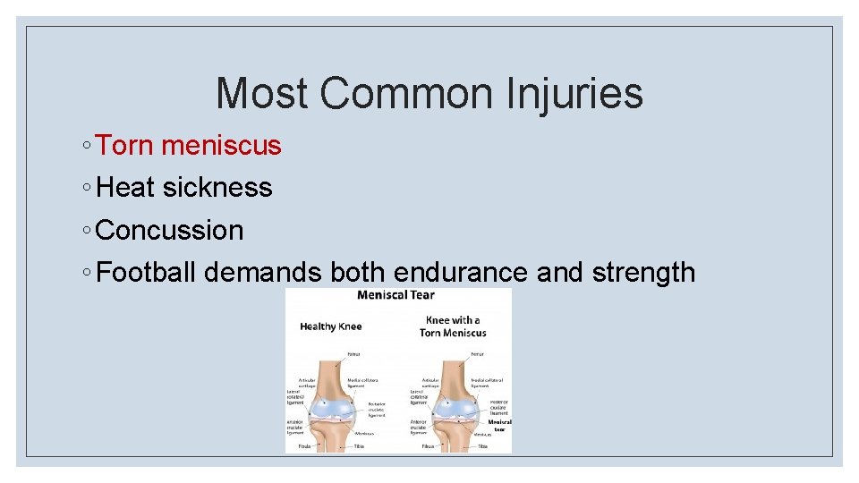 Most Common Injuries ◦ Torn meniscus ◦ Heat sickness ◦ Concussion ◦ Football demands