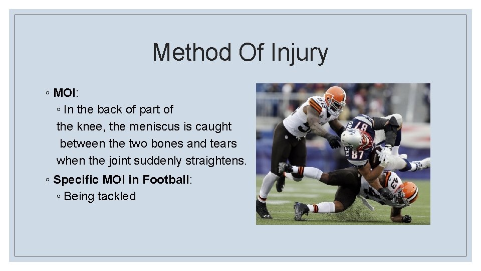 Method Of Injury ◦ MOI: ◦ In the back of part of the knee,
