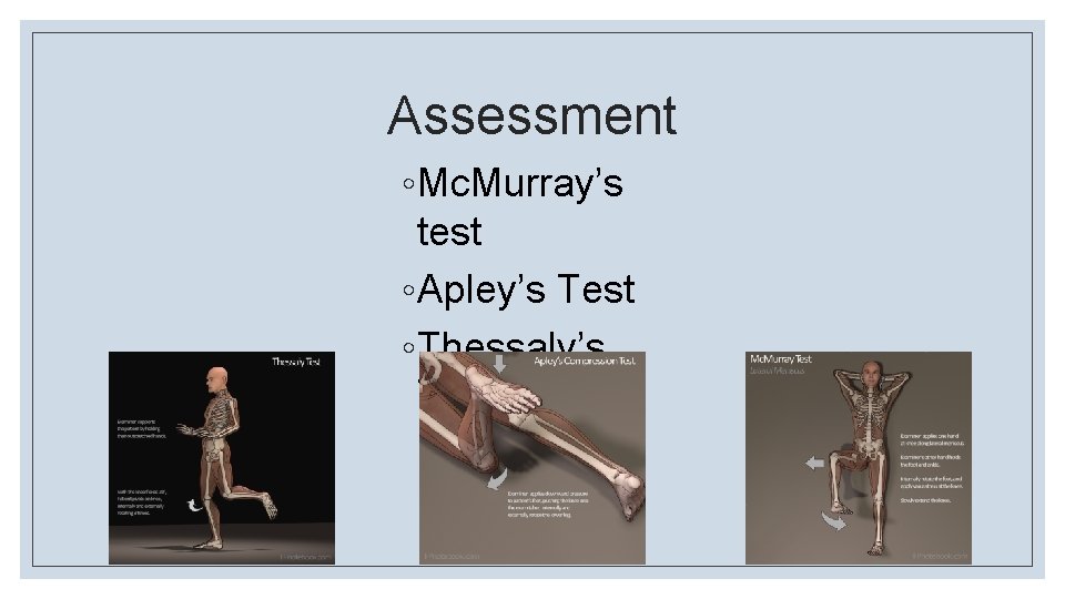 Assessment ◦ Mc. Murray’s test ◦ Apley’s Test ◦ Thessaly’s Test 