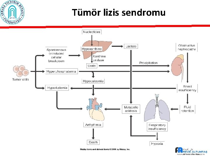 Tümör lizis sendromu 