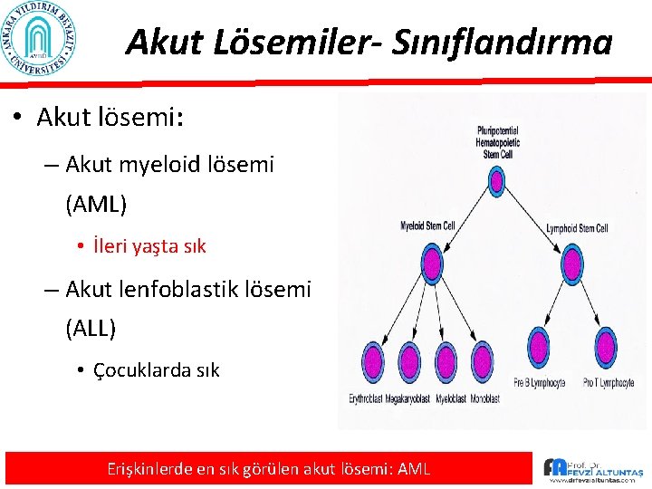 Akut Lösemiler- Sınıflandırma • Akut lösemi: – Akut myeloid lösemi (AML) • İleri yaşta