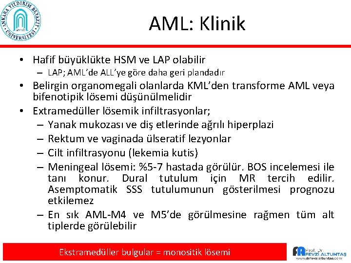 AML: Klinik • Hafif büyüklükte HSM ve LAP olabilir – LAP; AML’de ALL’ye göre