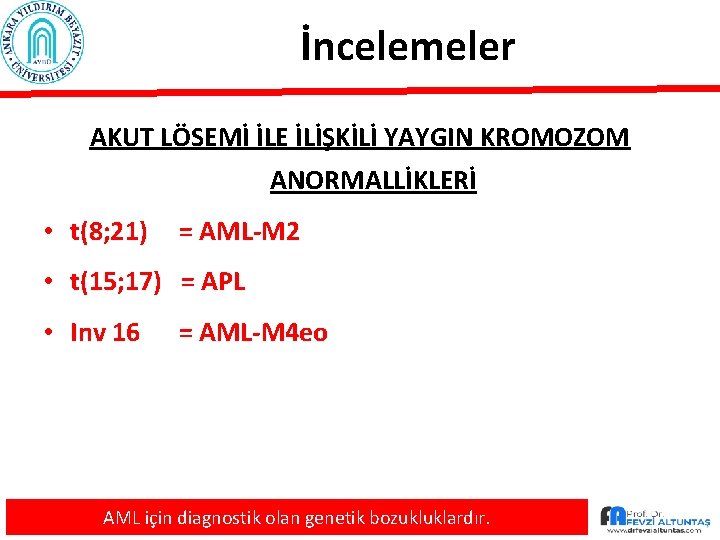 İncelemeler AKUT LÖSEMİ İLE İLİŞKİLİ YAYGIN KROMOZOM ANORMALLİKLERİ • t(8; 21) = AML-M 2
