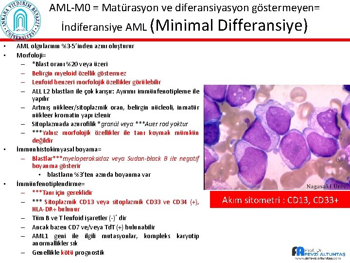 AML-M 0 = Matürasyon ve diferansiyasyon göstermeyen= İndiferansiye AML (Minimal • • AML olgularının