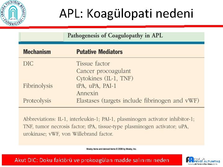 APL: Koagülopati nedeni Akut DIC: Doku faktörü ve prokoagülan madde salınımı neden 