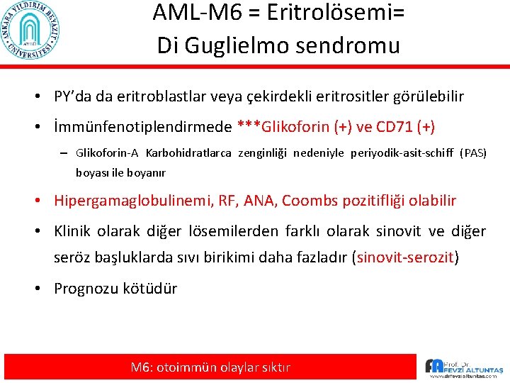 AML-M 6 = Eritrolösemi= Di Guglielmo sendromu • PY’da da eritroblastlar veya çekirdekli eritrositler