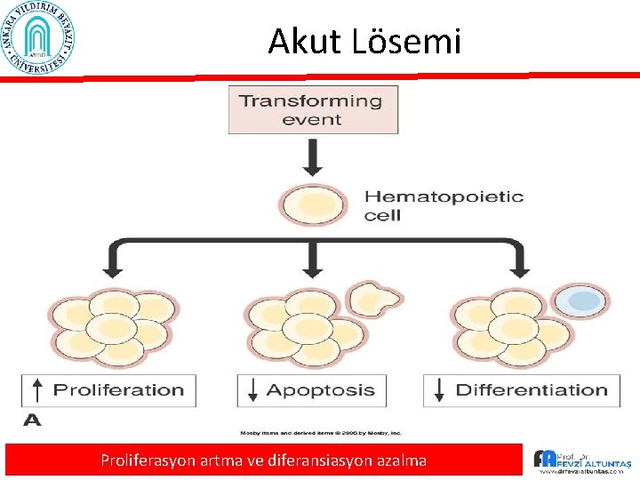 Akut Lösemi Proliferasyon artma ve diferansiasyon azalma 