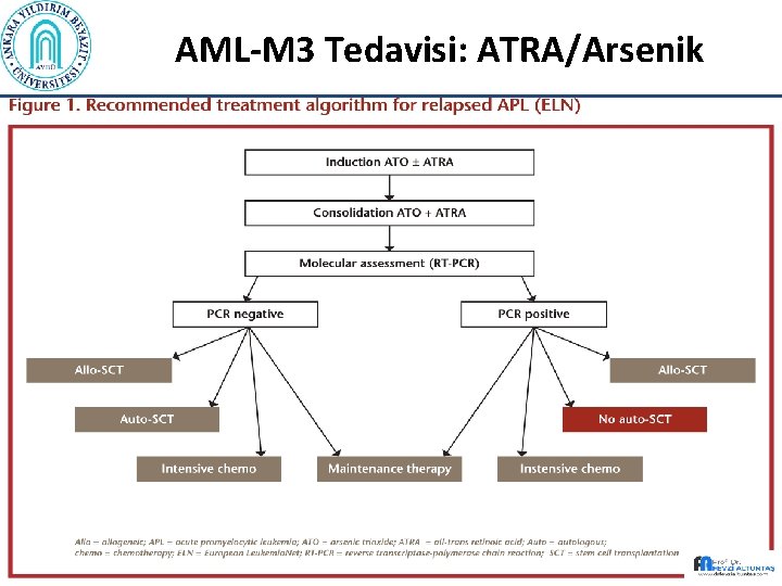 AML-M 3 Tedavisi: ATRA/Arsenik 