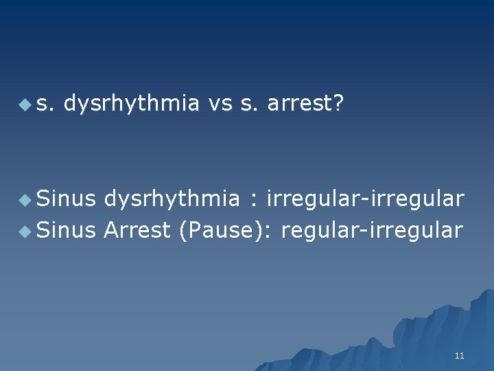 u s. dysrhythmia vs s. arrest? u Sinus dysrhythmia : irregular-irregular u Sinus Arrest