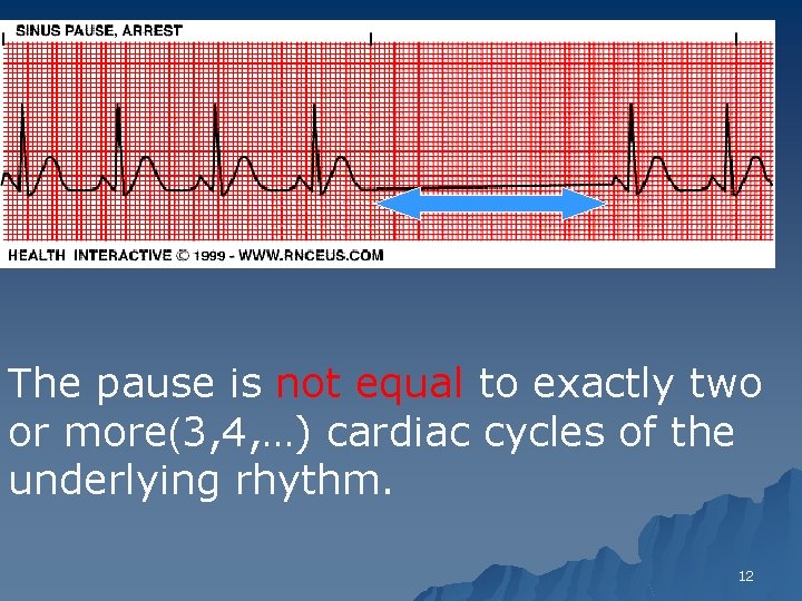 The pause is not equal to exactly two or more(3, 4, …) cardiac cycles