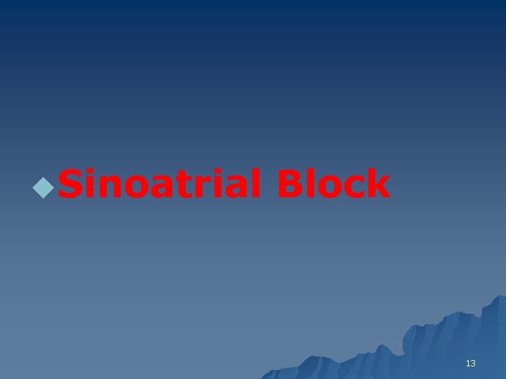 u. Sinoatrial Block 13 