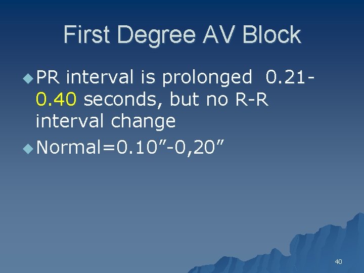 First Degree AV Block u PR interval is prolonged 0. 210. 40 seconds, but