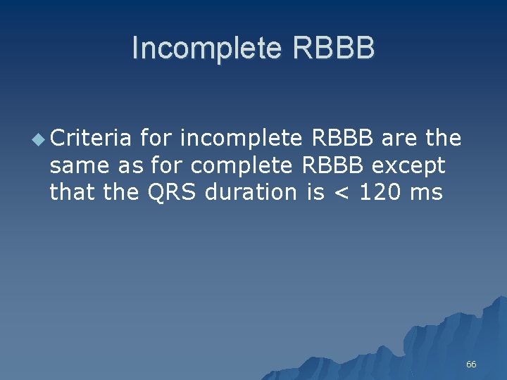 Incomplete RBBB u Criteria for incomplete RBBB are the same as for complete RBBB
