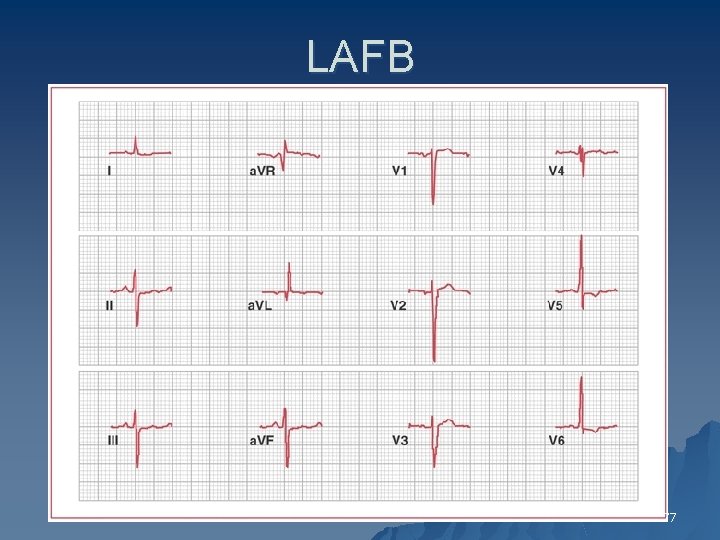 LAFB 77 