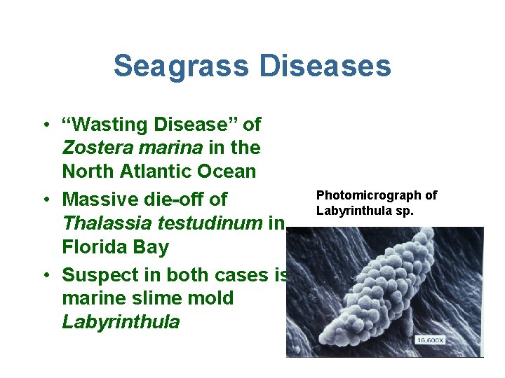 Seagrass Diseases • “Wasting Disease” of Zostera marina in the North Atlantic Ocean •