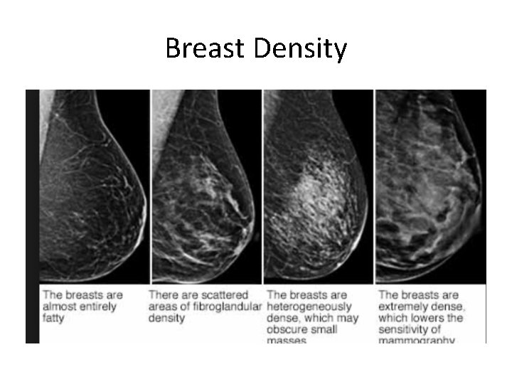 Breast Density 
