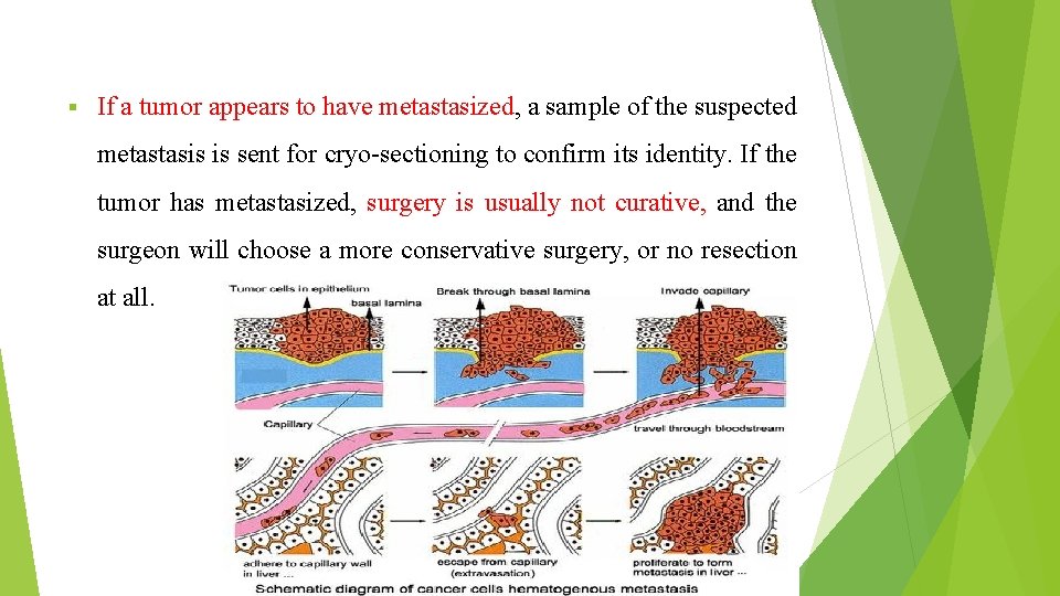 § If a tumor appears to have metastasized, a sample of the suspected metastasis