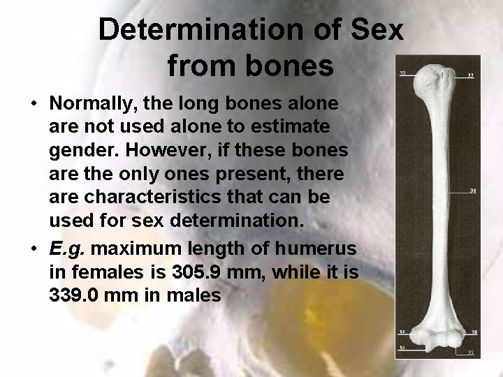 Determination of Sex from bones • Normally, the long bones alone are not used