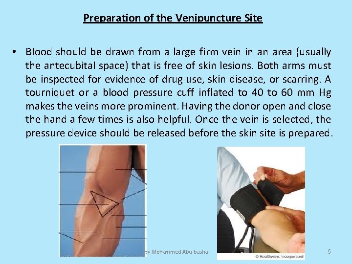 Preparation of the Venipuncture Site • Blood should be drawn from a large firm