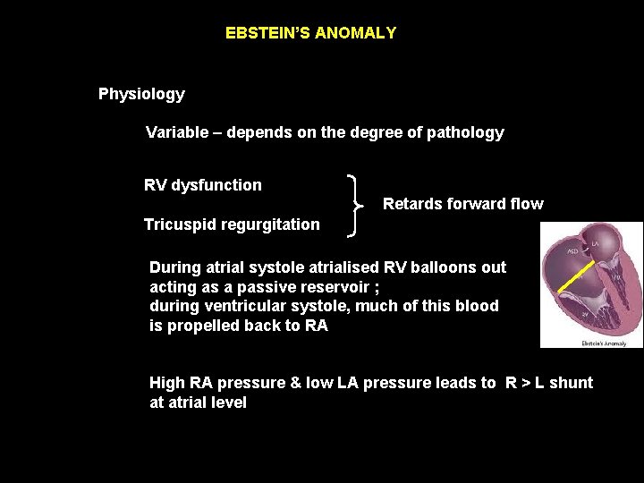 EBSTEIN’S ANOMALY Physiology Variable – depends on the degree of pathology RV dysfunction Retards