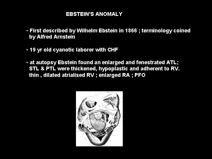 EBSTEIN’S ANOMALY • First described by Wilhelm Ebstein in 1866 ; terminology coined by