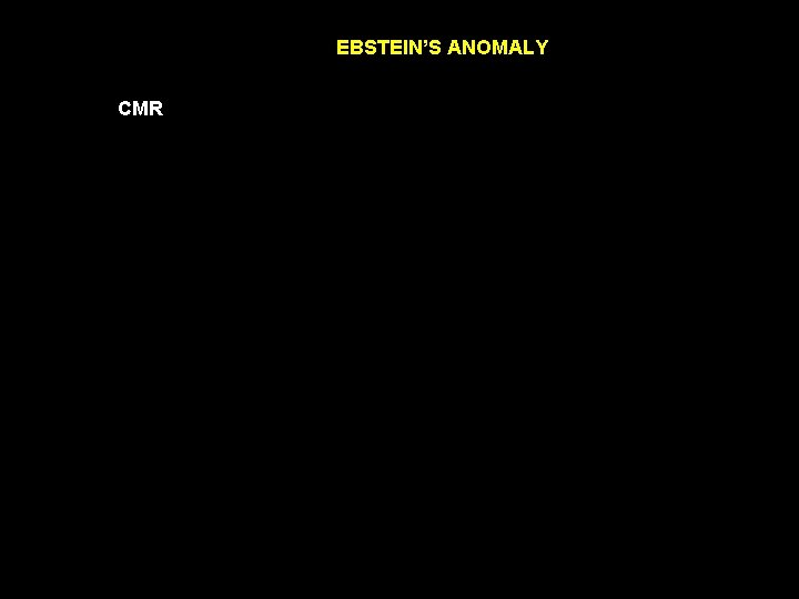 EBSTEIN’S ANOMALY CMR 