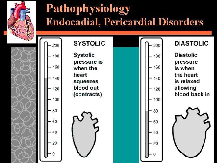 Pathophysiology Endocadial, Pericardial Disorders 