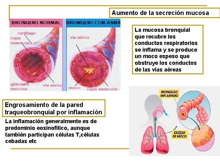 Aumento de la secreción mucosa La mucosa bronquial que recubre los conductos respiratorios se
