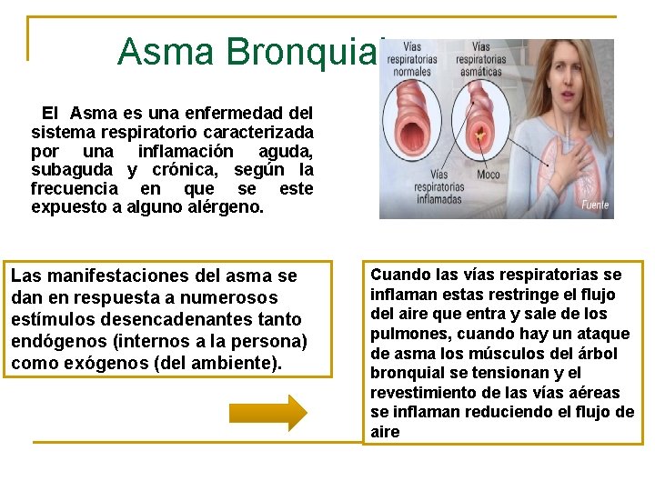 Asma Bronquial El Asma es una enfermedad del sistema respiratorio caracterizada por una inflamación