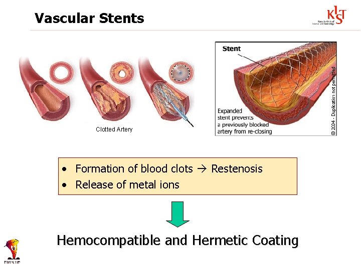 Vascular Stents Clotted Artery • Formation of blood clots Restenosis • Release of metal