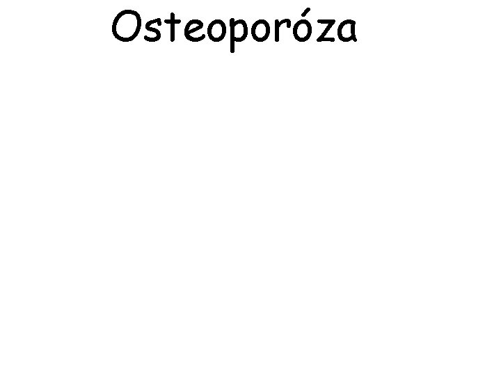 Osteoporóza 