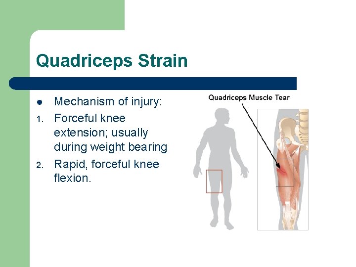 Quadriceps Strain l 1. 2. Mechanism of injury: Forceful knee extension; usually during weight