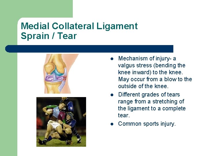 Medial Collateral Ligament Sprain / Tear l l l Mechanism of injury- a valgus