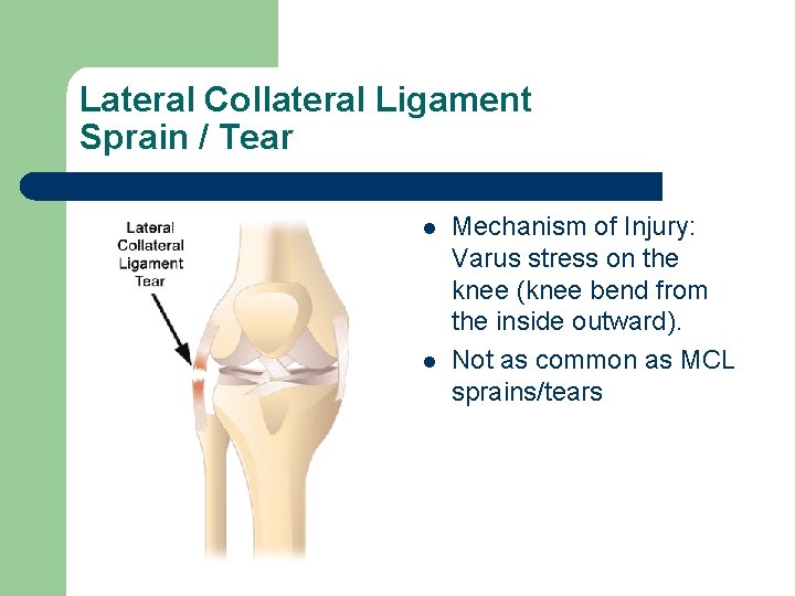 Lateral Collateral Ligament Sprain / Tear l l Mechanism of Injury: Varus stress on