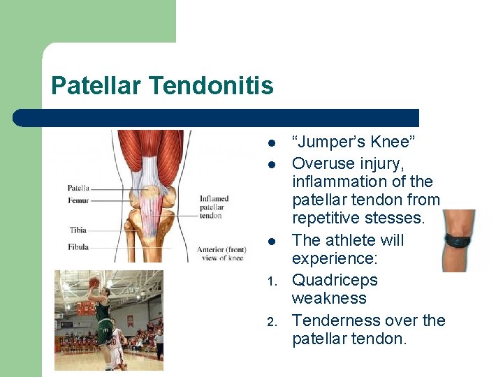 Patellar Tendonitis l l l 1. 2. “Jumper’s Knee” Overuse injury, inflammation of the