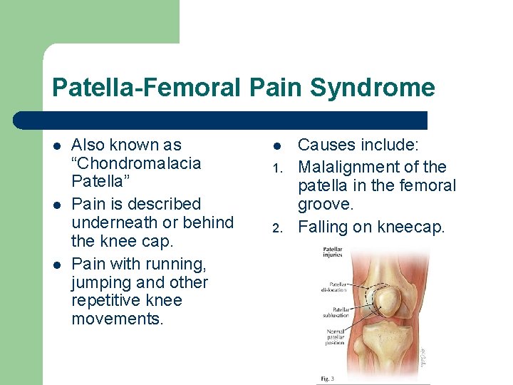 Patella-Femoral Pain Syndrome l l l Also known as “Chondromalacia Patella” Pain is described