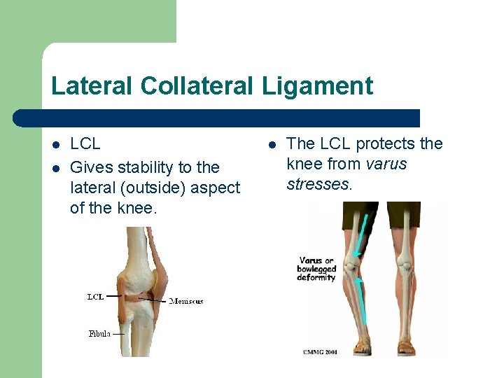 Lateral Collateral Ligament l l LCL Gives stability to the lateral (outside) aspect of