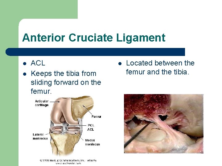 Anterior Cruciate Ligament l l ACL Keeps the tibia from sliding forward on the