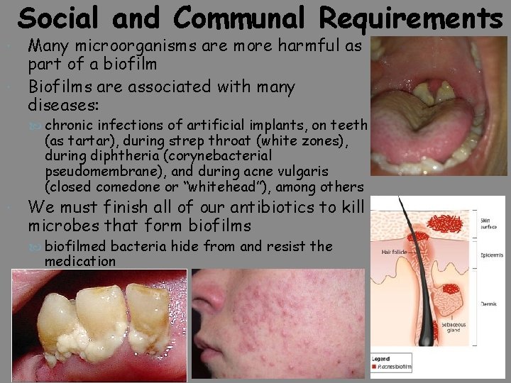 Social and Communal Requirements Many microorganisms are more harmful as part of a biofilm