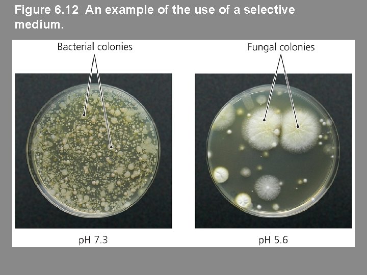 Figure 6. 12 An example of the use of a selective medium. 