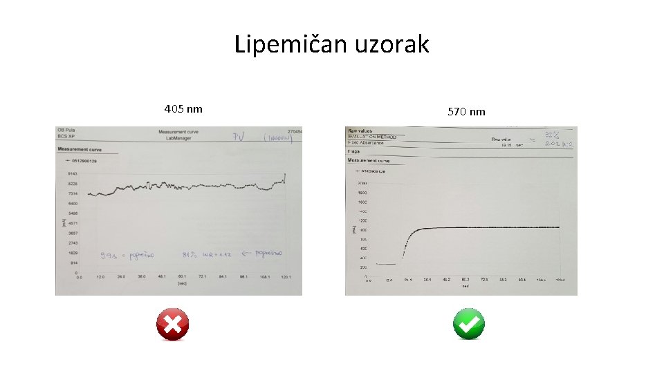 Lipemičan uzorak 405 nm 570 nm 