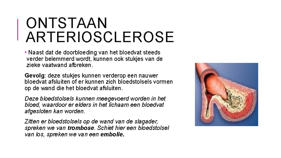 ONTSTAAN ARTERIOSCLEROSE • Naast dat de doorbloeding van het bloedvat steeds verder belemmerd wordt,