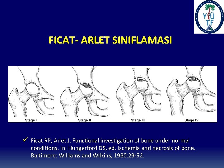 FICAT- ARLET SINIFLAMASI ü Ficat RP, Arlet J. Functional investigation of bone under normal