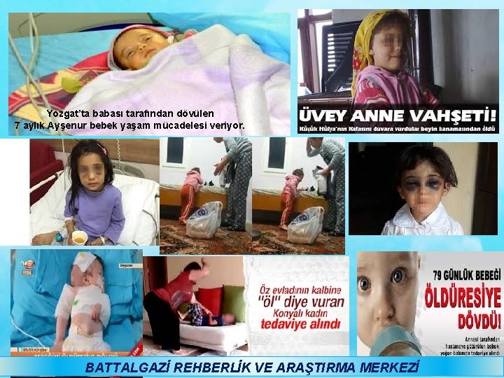 Yozgat’ta babası tarafından dövülen 7 aylık Ayşenur bebek yaşam mücadelesi veriyor. BATTALGAZİ REHBERLİK VE